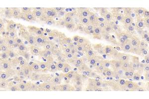 Detection of MAOA in Rat Liver Tissue using Polyclonal Antibody to Monoamine Oxidase A (MAOA)