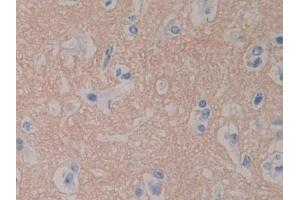 DAB staining on IHC-P; Samples: Human Cerebrum Tissue (RPN1 antibody  (AA 24-179))