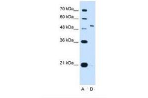 Image no. 1 for anti-Potassium Voltage-Gated Channel, Shaw-Related Subfamily, Member 1 (KCNC1) (AA 21-70) antibody (ABIN321117)
