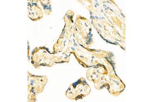 Immunohistochemistry of paraffin embedded human placenta using GRASP (ABIN7074140) at dilution of 1:400 (400x lens) (Tamalin/GRASP antibody)