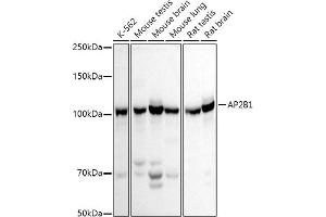 Western blot analysis of extracts of various cell lines, using B1 antibody (ABIN3015809, ABIN3015810, ABIN3015811 and ABIN6219156) at 1:500 dilution. (AP2B1 antibody  (AA 752-951))