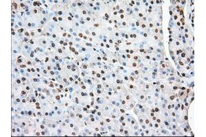 Immunohistochemical staining of paraffin-embedded Human liver tissue using anti-ACAT2 mouse monoclonal antibody. (ACAT2 antibody)