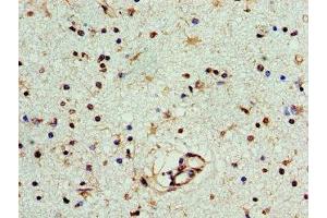 Immunohistochemistry of paraffin-embedded human brain tissue using ABIN7166631 at dilution of 1:100 (PNP antibody  (AA 1-289))