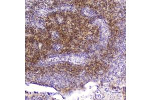 IHC analysis of Cardiac FABP using anti-Cardiac FABP antibody (ABIN5693024).