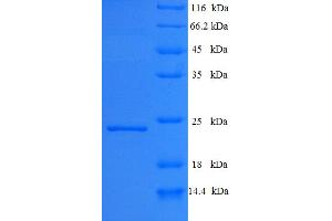 SDS-PAGE (SDS) image for Polymerase (DNA Directed) nu (POLN) (AA 60-240) protein (His tag) (ABIN5710850) (POLN Protein (AA 60-240) (His tag))