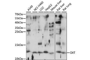 Western blot analysis of extracts of various cell lines, using OXT antibody (ABIN7269141) at 1:1000 dilution. (OXT antibody  (AA 1-125))