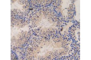 Used in DAB staining on fromalin fixed paraffin- embedded testis tissue (SSFA2 antibody  (AA 587-802))