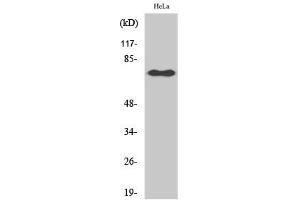 Western Blotting (WB) image for anti-Nuclear Factor-kB p65 (NFkBP65) (pSer529) antibody (ABIN5961223) (NF-kB p65 antibody  (pSer529))