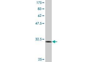 Western Blot detection against Immunogen (32. (RNF2 antibody  (AA 164-223))