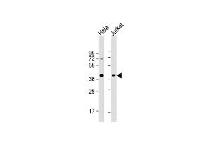 All lanes : Anti-HSP40 Antibody at 1:4000 dilution Lane 1: Hela whole cell lysate Lane 2: Jurkat whole cell lysate Lysates/proteins at 20 μg per lane. (DNAJB1 antibody)