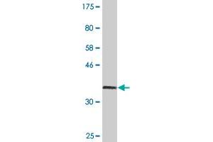 Western Blot detection against Immunogen (36. (Catalase antibody  (AA 1-100))