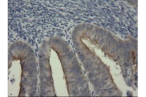 Image no. 3 for anti-serpin Peptidase Inhibitor, Clade B (Ovalbumin), Member 3 (SERPINB3) antibody (ABIN1500886) (SERPINB3 antibody)