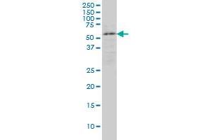 ENC1 monoclonal antibody (M02), clone 3B1 Western Blot analysis of ENC1 expression in IMR-32 . (ENC1 antibody  (AA 17-98))