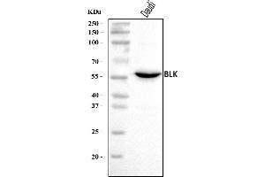 Western blot analysis of BLK using anti-BLK antibody (ABIN7601971).