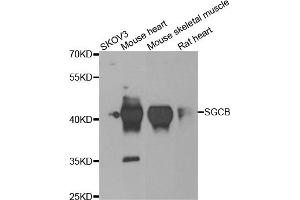 Western blot analysis of extracts of various cell lines, using SGCB antibody. (SGCB antibody)