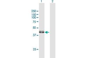 Western Blot analysis of ACADM expression in transfected 293T cell line by ACADM MaxPab polyclonal antibody. (Medium-Chain Specific Acyl-CoA Dehydrogenase, Mitochondrial (MCAD) (AA 1-421) antibody)