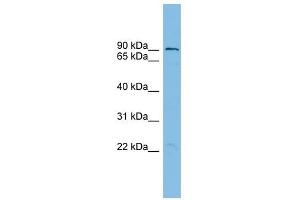 TBC1D16 antibody used at 1 ug/ml to detect target protein.