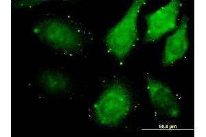 Immunofluorescence of monoclonal antibody to ZAK on HeLa cell. (ZAK antibody  (AA 1-455))