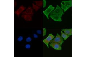 ABIN6262532 and ABIN6276906 staining Hela cells by IF/ICC. (IL-10RA antibody  (C-Term))