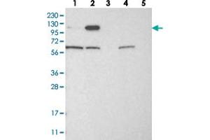Western blot analysis of Lane 1: RT-4, Lane 2: U-251 MG, Lane 3: Human Plasma, Lane 4: Liver, Lane 5: Tonsil with IGSF9 polyclonal antibody . (IGSF9 antibody)