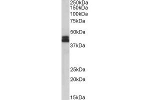 Western Blotting (WB) image for anti-Major Histocompatibility Complex, Class I, B (HLA-B) (Internal Region) antibody (ABIN5539556)