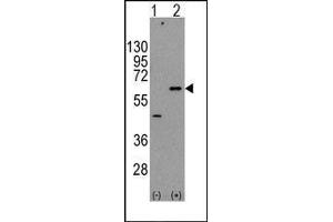 Western blot analysis of AKT3 (arrow) using rabbit polyclonal AKT3 Antibody. (AKT3 antibody  (Ser472))
