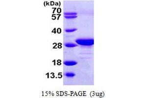 SDS-PAGE (SDS) image for Eukaryotic Translation Elongation Factor 1 beta 2 (EEF1B2) (AA 1-225) protein (His tag) (ABIN667375) (EEF1B2 Protein (AA 1-225) (His tag))