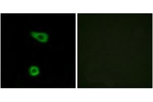 Immunofluorescence analysis of HuvEc cells, using TNAP2 Antibody. (TNFAIP2 antibody  (AA 131-180))