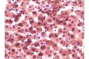 Immunohistochemistry (IHC) image for anti-Casein Kinase 1, alpha 1 (CSNK1A1) (truncated) antibody (ABIN2464037) (CSNK1A1 antibody  (truncated))