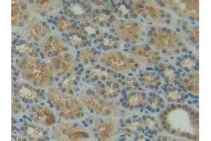 Immunohistochemistry (IHC) image for anti-Heat Shock Protein 90kDa alpha (Cytosolic), Class A Member 1 (HSP90AA1) (AA 698-732) antibody (ABIN7443815)