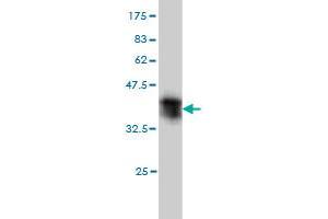 Western Blot detection against Immunogen (36. (ST3GAL2 antibody  (AA 28-127))