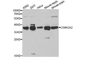Western blot analysis of extracts of various cell lines, using CSNK2A2 antibody. (CSNK2A2 antibody  (AA 1-350))