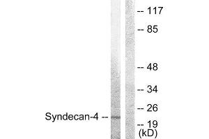 Western Blotting (WB) image for anti-Syndecan 4 (SDC4) (Ser179) antibody (ABIN1848043) (SDC4 antibody  (Ser179))