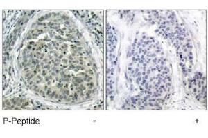 Image no. 1 for anti-Catenin (Cadherin-Associated Protein), beta 1, 88kDa (CTNNB1) (pSer37) antibody (ABIN196959) (CTNNB1 antibody  (pSer37))