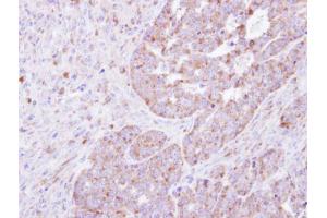 Immunohistochemistry (IHC) image for anti-Phenylalanyl-tRNA Synthetase, alpha Subunit (FARSA) antibody (ABIN2855995)