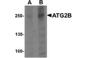 Western blot analysis of ATG2B in K562 cell lysate with ATG2B Antibody  at (A) 1 and (B) 2 μg/ml. (ATG2B antibody  (N-Term))