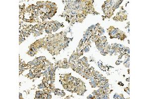 IHC analysis of Hexokinase 1/HK1 using anti-Hexokinase 1/HK1 antibody (ABIN7600259). (Hexokinase 1 antibody  (AA 17-323))