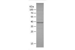 Western Blotting (WB) image for Armadillo Repeat Containing, X-Linked 1 (ARMCX1) (AA 273-437) protein (His-IF2DI Tag) (ABIN7282898) (ARMCX1 Protein (AA 273-437) (His-IF2DI Tag))