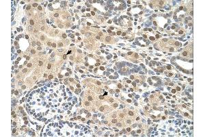 Immunohistochemistry (IHC) image for anti-Transmembrane Protein 30A (TMEM30A) (Middle Region) antibody (ABIN2782953) (TMEM30A antibody  (Middle Region))
