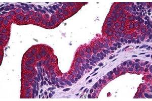 Human Prostate: Formalin-Fixed, Paraffin-Embedded (FFPE) (MAPK13 antibody  (AA 251-365))