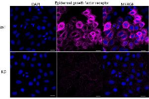 Immunocytochemical staining of HepG2 cells using Epidermal growth factor receptor antibody (ABIN7798473), 1:1,000), Top panel: wild-type (WT), Bottom panal: Adiponectin receptor 1 shRNA knockdown (KD). (EGFR antibody)