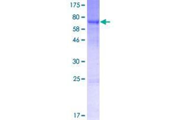 SRPX2 Protein (AA 1-465) (GST tag)