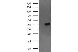 Image no. 3 for anti-Chromosome 2 Open Reading Frame 62 (C2orf62) antibody (ABIN1497053) (C2orf62 antibody)
