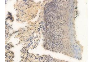 ABIN6265700 and ABIN6266665 at 1/100 staining human normal tonsil tissue by IHC-P. (TRADD antibody  (N-Term))