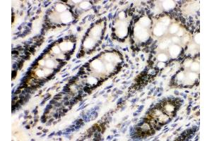 Anti- EME1 Picoband antibody,IHC(P) IHC(P): Rat Intestine Tissue