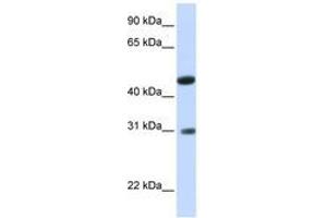 Image no. 1 for anti-Glycolipid Transfer Protein Domain Containing 2 (GLTPD2) (AA 36-85) antibody (ABIN6740898) (GLTPD2 antibody  (AA 36-85))