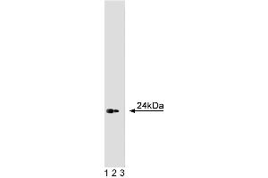 Western blot analysis of Caveolin 1 on a human endothelial cell lysate. (Caveolin-1 antibody  (AA 1-178))