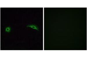 Immunofluorescence analysis of A549 cells, using OR2J2 Antibody. (OR2J2 antibody  (AA 263-312))
