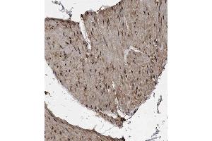 Immunohistochemical analysis of B on paraffin-embedded Human bladder tissue. (MET10 (AA 444-472), (C-Term) antibody)