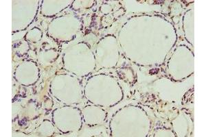 Immunohistochemistry of paraffin-embedded human thyroid tissue using ABIN7161975 at dilution of 1:100 (NOL4L (AA 101-300) antibody)